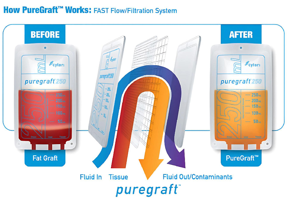 pure-graft-03